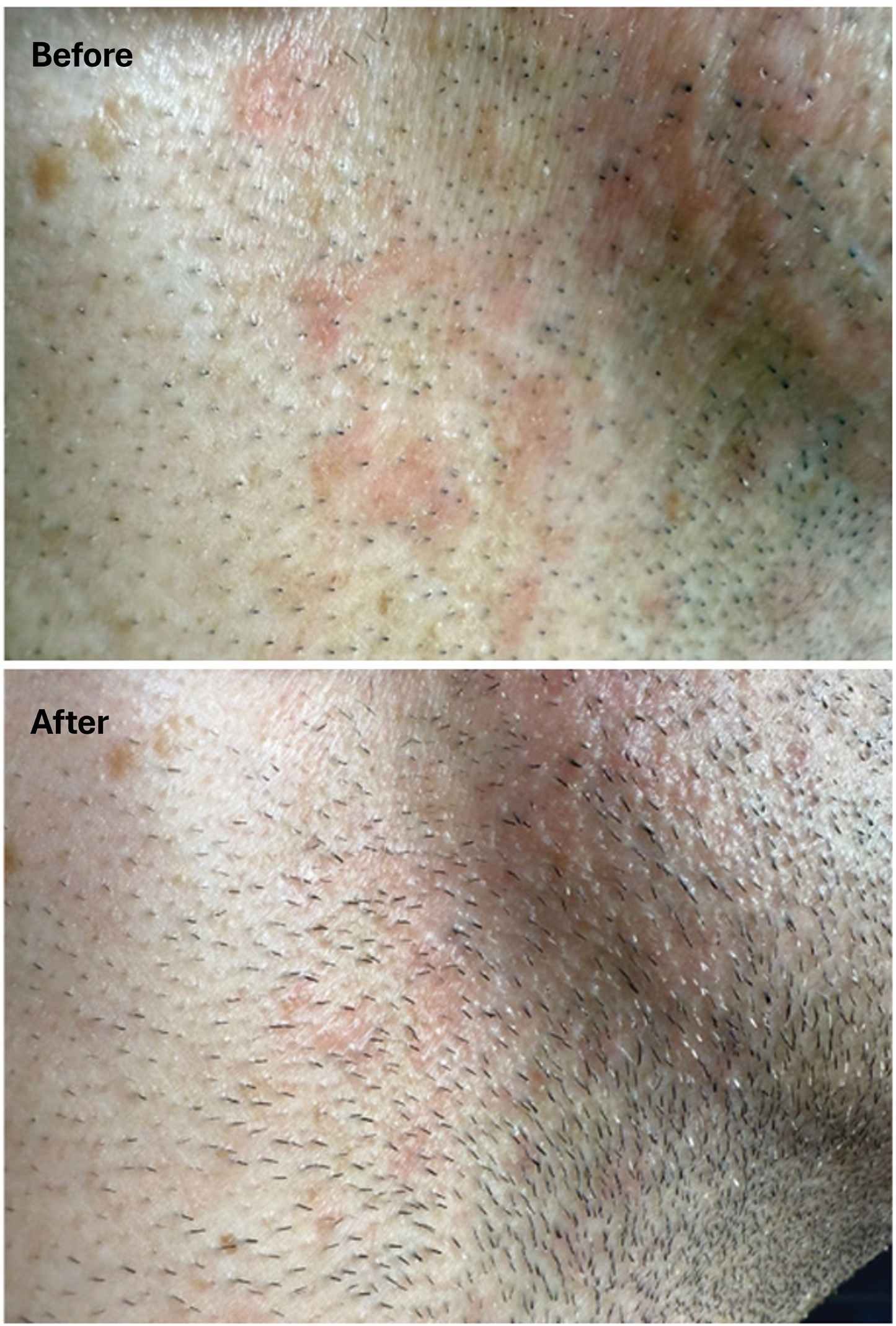 OCEAN INFINITE CARE: Tägliches schützendes und feuchtigkeitsspendendes Gesichtsserum