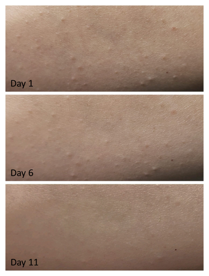 OCEAN ADVANCE PERFECTION: Regenerating Face Serum with AHA-PHA Acids