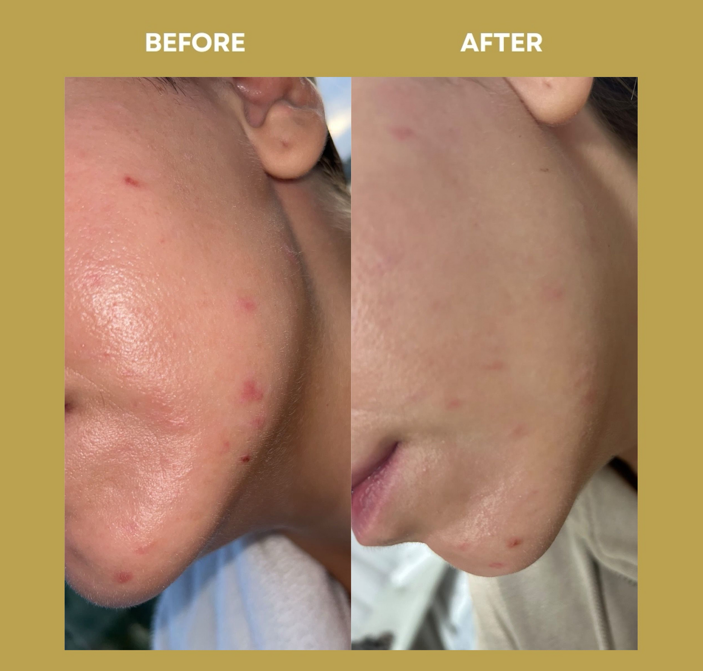 OCEAN ADVANCED REPAIR: Reparaturcreme | Anti-Unreinheiten