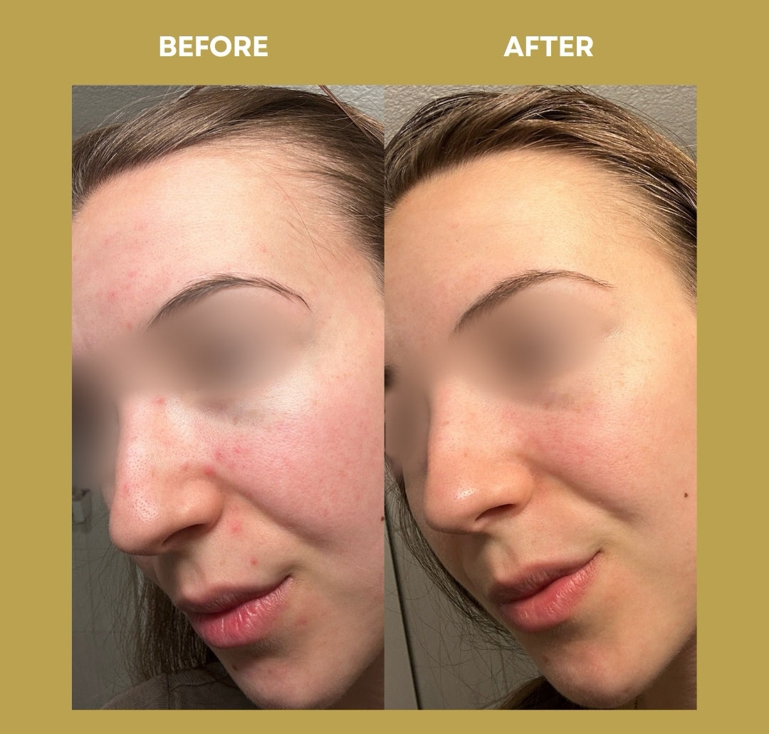 OCEAN ADVANCED REPAIR: Reparaturcreme | Anti-Unreinheiten